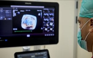 monitor view